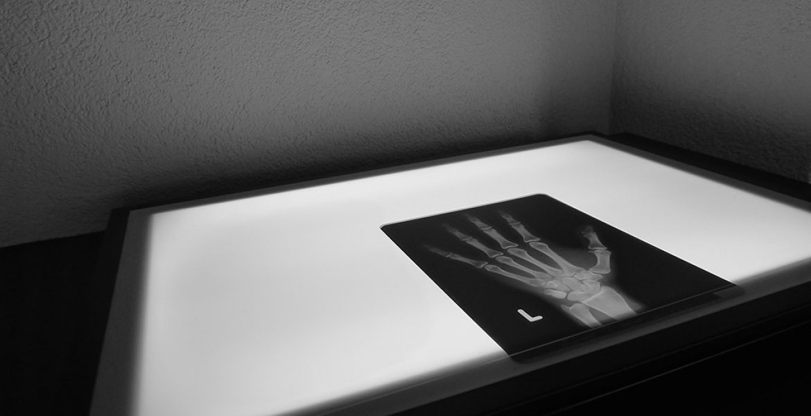 Eröffnung Handchirurgie Seefeld