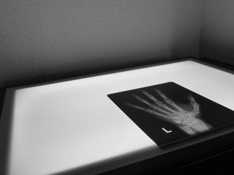 Eröffnung Handchirurgie Seefeld