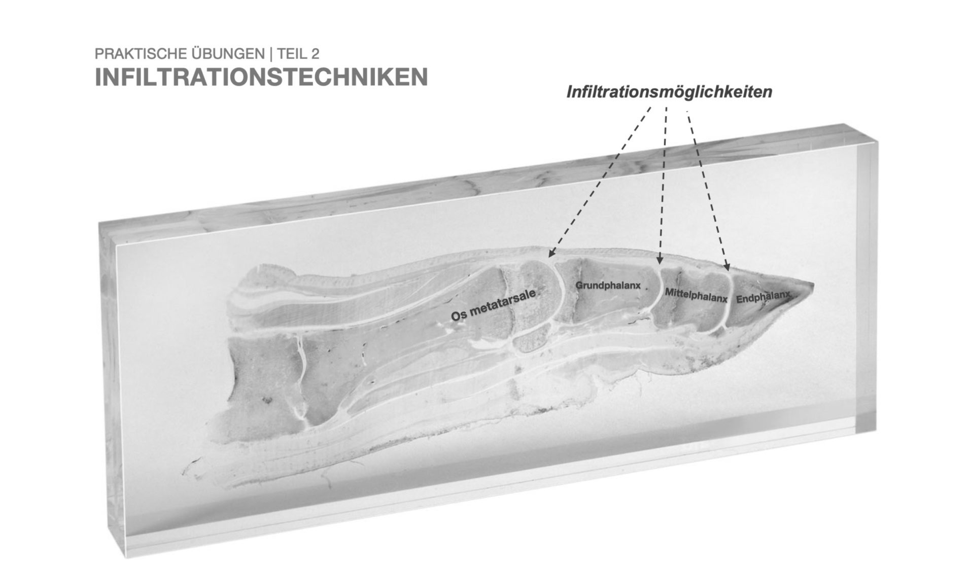 Fortbildungskurs Ultraschalldiagnostik der Hand | Dr. Sebastian Kluge | Handchirurgie Seefeld